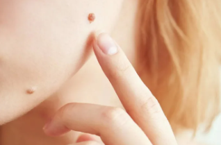 Melindungi Kulit untuk Penampilan yang Sehat dan Segar